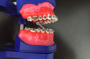 Como Instalar Um Aparelho Propulsor Mandibular Em Seu Paciente