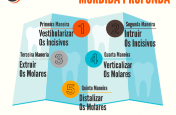 5 Maneiras De Corrigir A Mordida Profunda