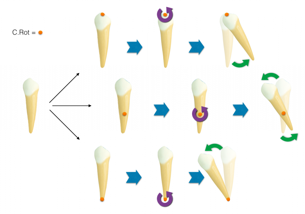 demonstração de um mesmo dente unirradicular com 3 centros de rotação diferentes